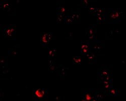 Invitrogen TDP-43 Polyclonal Antibody 100 &mu;g; Unconjugated:Antibodies,