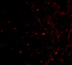 Invitrogen RAP80 Polyclonal Antibody 100 &mu;g; Unconjugated:Antibodies,