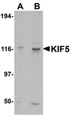 Invitrogen Kinesin 5A Polyclonal Antibody 100 &mu;g | Buy Online | Invitrogen&trade; | Fisher Scientific