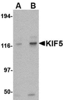 Kinesin 5A Polyclonal Antibody, Invitrogen 100 &mu;g; Unconjugated:Antibodies
