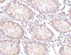 Invitrogen PTK7 Polyclonal Antibody 100 &mu;g; Unconjugated:Antibodies,