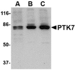 Invitrogen PTK7 Polyclonal Antibody 100 &mu;g; Unconjugated:Antibodies,