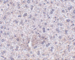 Invitrogen TEM7 Polyclonal Antibody 100 &mu;g; Unconjugated:Antibodies,