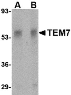 Invitrogen TEM7 Polyclonal Antibody 100 &mu;g; Unconjugated:Antibodies,