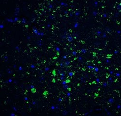 Invitrogen CDNF Polyclonal Antibody 100 μg; Unconjugated:Antibodies,
