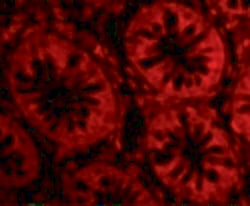 Invitrogen CD248 Polyclonal Antibody 100 &mu;g | Buy Online | Invitrogen&trade; | Fisher Scientific