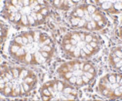 Invitrogen CD248 Polyclonal Antibody 100 &mu;g | Buy Online | Invitrogen&trade; | Fisher Scientific