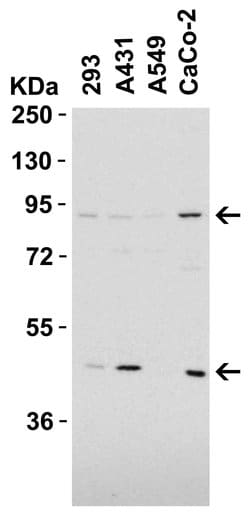 Invitrogen CD248 Polyclonal Antibody 100 &mu;g | Buy Online | Invitrogen&trade; | Fisher Scientific