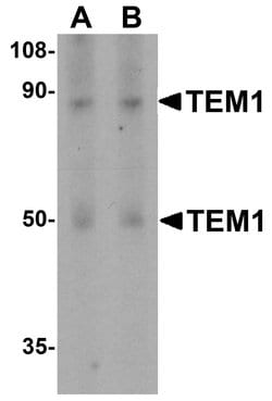 Invitrogen CD248 Polyclonal Antibody 100 &mu;g | Buy Online | Invitrogen&trade; | Fisher Scientific