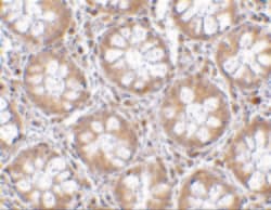 Invitrogen RASD2 Polyclonal Antibody 100 &mu;g; Unconjugated:Antibodies,