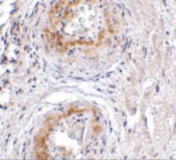 Invitrogen TEM5 Polyclonal Antibody 100 &mu;g | Buy Online | Invitrogen&trade; | Fisher Scientific