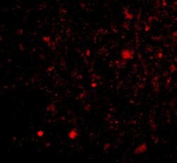 Invitrogen TOCA-1 Polyclonal Antibody 100 &mu;g | Buy Online | Invitrogen&trade; | Fisher Scientific