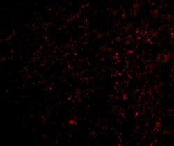 Invitrogen TOCA-1 Polyclonal Antibody 100 &mu;g | Buy Online | Invitrogen&trade; | Fisher Scientific