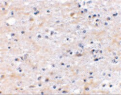 Invitrogen TOCA-1 Polyclonal Antibody 100 &mu;g | Buy Online | Invitrogen&trade; | Fisher Scientific