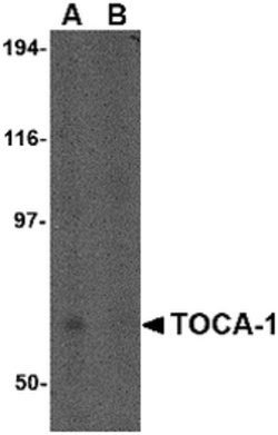 Invitrogen TOCA-1 Polyclonal Antibody 100 &mu;g | Buy Online | Invitrogen&trade; | Fisher Scientific