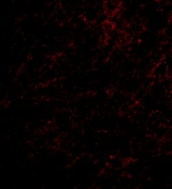Invitrogen Nhe-1 Polyclonal Antibody 100 &mu;g; Unconjugated:Antibodies,