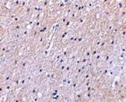 Invitrogen Nhe-1 Polyclonal Antibody 100 &mu;g; Unconjugated:Antibodies,