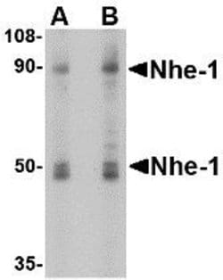 Invitrogen Nhe-1 Polyclonal Antibody 100 &mu;g; Unconjugated:Antibodies,