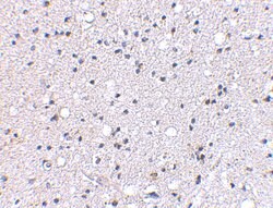 Invitrogen GRIK4 Polyclonal Antibody 100 &mu;g; Unconjugated:Antibodies,