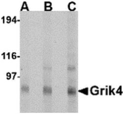 Invitrogen GRIK4 Polyclonal Antibody 100 &mu;g | Buy Online | Invitrogen&trade; | Fisher Scientific