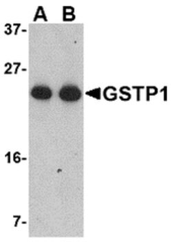 Invitrogen GSTP1 Polyclonal Antibody 100 μg; Unconjugated:Antibodies,
