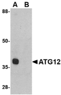 Invitrogen ATG12 Polyclonal Antibody 100 &mu;g | Buy Online | Invitrogen&trade; | Fisher Scientific