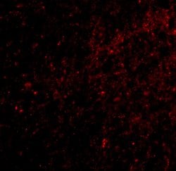 Invitrogen&trade;&nbsp;SAPAP3 Polyclonal Antibody