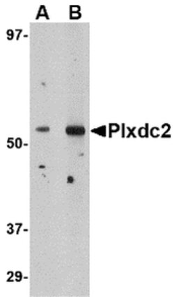 PLXDC2 Polyclonal Antibody, Invitrogen 100 &mu;g; Unconjugated:Antikroppar