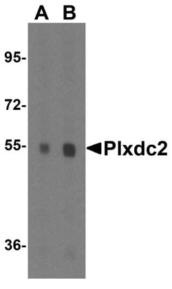 PLXDC2 Polyclonal Antibody, Invitrogen 100 &mu;g; Unconjugated:Antikroppar