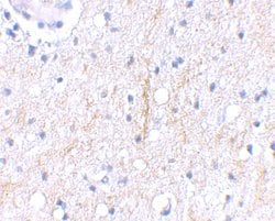 Invitrogen PLXDC2 Polyclonal Antibody 100 &mu;g; Unconjugated:Antibodies,