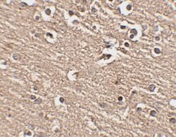 Invitrogen SLITRK1 Polyclonal Antibody 100 &mu;g; Unconjugated:Antibodies,