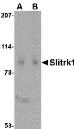 Invitrogen SLITRK1 Polyclonal Antibody 100 &mu;g; Unconjugated:Antibodies,