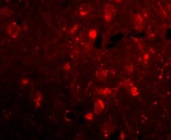 Invitrogen SLITRK2 Polyclonal Antibody 100 &mu;g; Unconjugated:Antibodies,