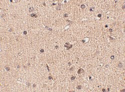 Invitrogen SLITRK2 Polyclonal Antibody 100 &mu;g; Unconjugated:Antibodies,