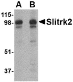 Invitrogen SLITRK2 Polyclonal Antibody 100 &mu;g; Unconjugated:Antibodies,