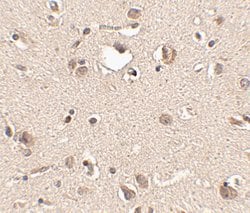 Invitrogen SLITRK3 Polyclonal Antibody 100 &mu;g | Buy Online | Invitrogen&trade; | Fisher Scientific