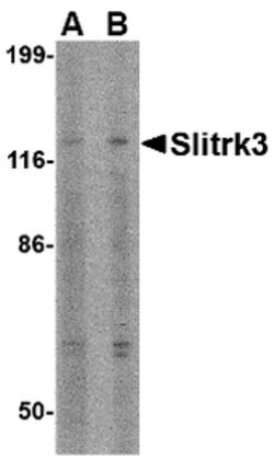 Invitrogen SLITRK3 Polyclonal Antibody 100 &mu;g | Buy Online | Invitrogen&trade; | Fisher Scientific