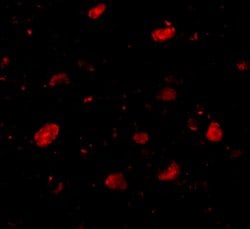 Invitrogen SLITRK5 Polyclonal Antibody 100 &mu;g; Unconjugated:Antibodies,