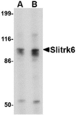 Invitrogen SLITRK6 Polyclonal Antibody 100 &mu;g; Unconjugated:Antibodies,