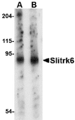 Invitrogen SLITRK6 Polyclonal Antibody 100 &mu;g | Buy Online | Invitrogen&trade; | Fisher Scientific