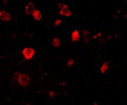 SLITRK4 Polyclonal Antibody, Invitrogen 100 &mu;g; Unconjugated:Antibodies