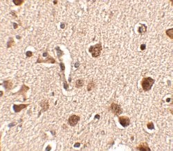 SLITRK4 Polyclonal Antibody, Invitrogen 100 &mu;g; Unconjugated:Antibodies