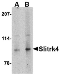 SLITRK4 Polyclonal Antibody, Invitrogen 100 &mu;g; Unconjugated:Antibodies