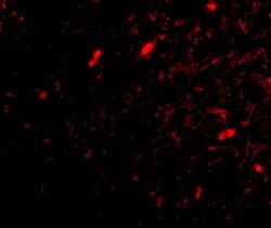 Invitrogen FBXL20 Polyclonal Antibody 100 &mu;g | Buy Online | Invitrogen&trade; | Fisher Scientific