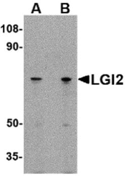 LGI2 Polyclonal Antibody, Invitrogen 100 &mu;g; Unconjugated:Antibodies