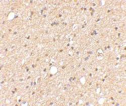 Invitrogen LGI2 Polyclonal Antibody 100 &mu;g | Buy Online | Invitrogen&trade; | Fisher Scientific