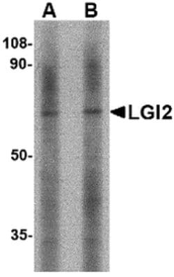 Invitrogen LGI2 Polyclonal Antibody 100 &mu;g | Buy Online | Invitrogen&trade; | Fisher Scientific
