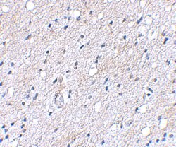Invitrogen BAP3 Polyclonal Antibody 100 &mu;g | Buy Online | Invitrogen&trade; | Fisher Scientific
