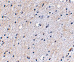 Invitrogen NIPSNAP1 Polyclonal Antibody 100 &mu;g; Unconjugated:Antibodies,