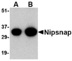 Invitrogen NIPSNAP1 Polyclonal Antibody 100 &mu;g; Unconjugated:Antibodies,